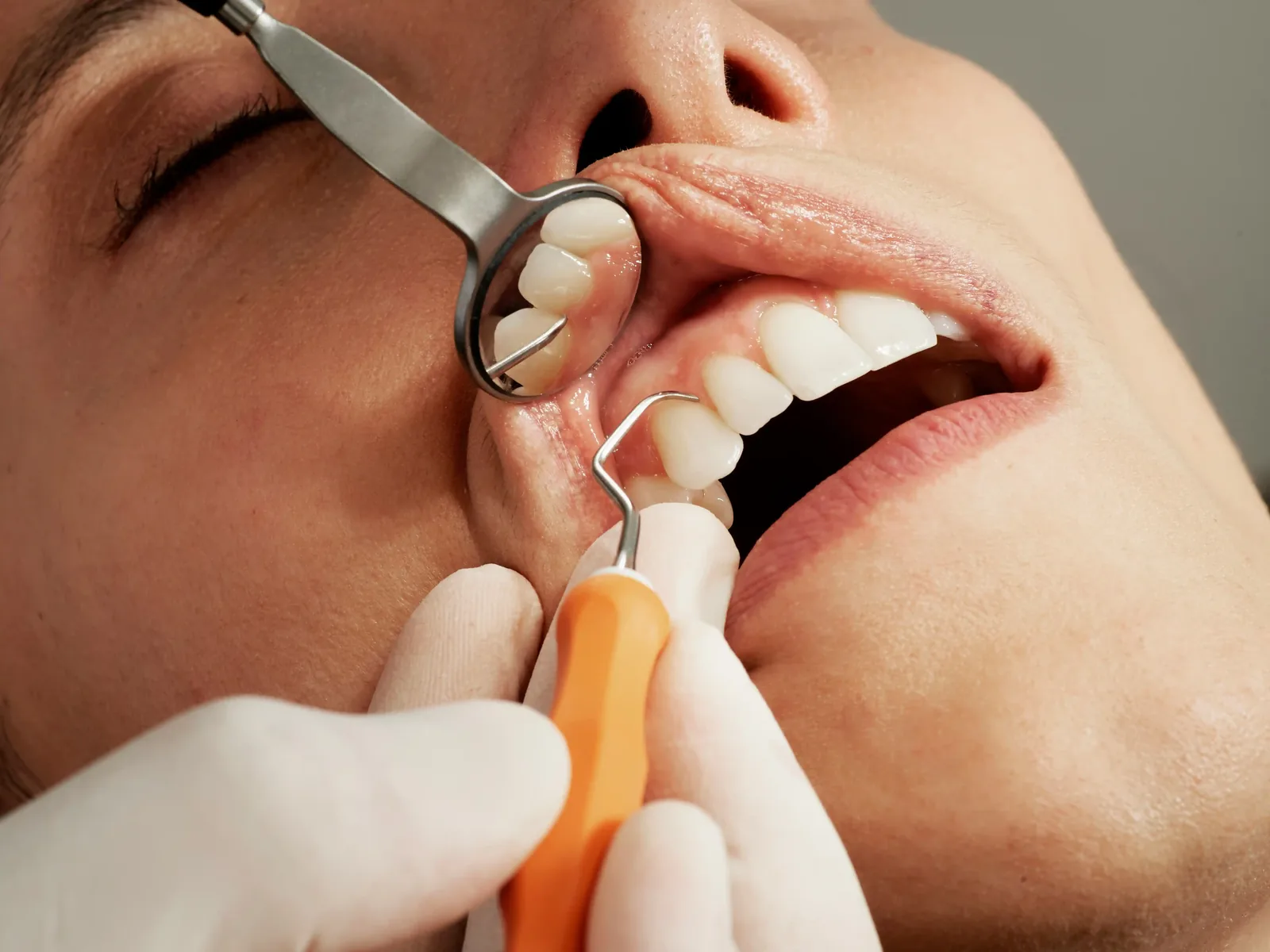 Cleaning & exams at a Unionville dental office