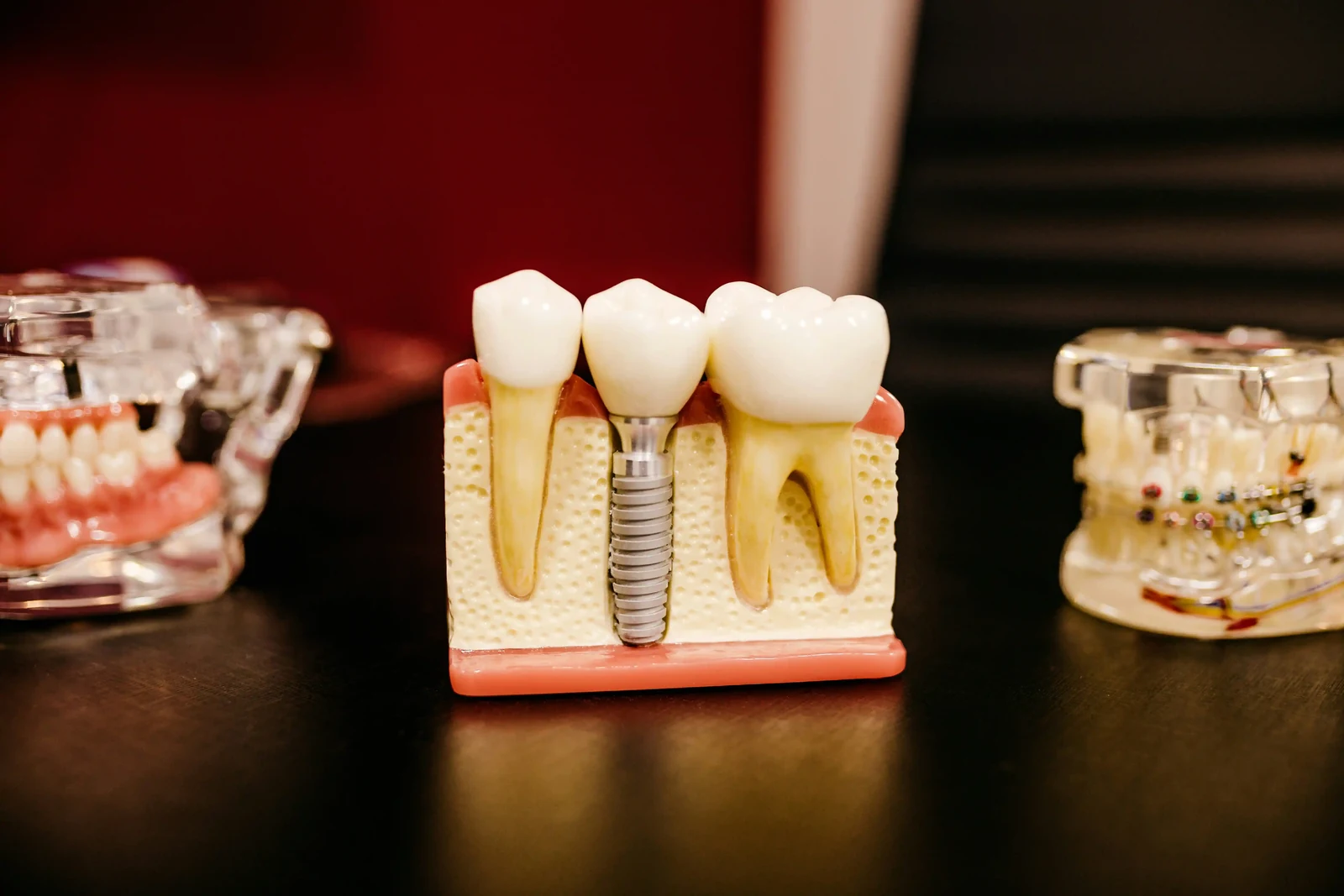 Restorative care at a Unionville dental office