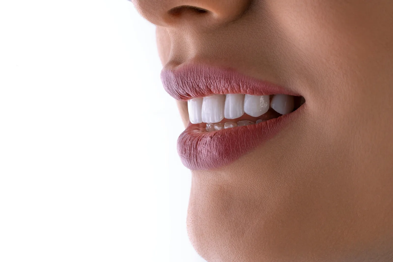 Natural patient smile for Markham families comparing local dental care